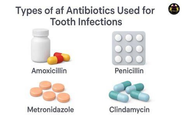 Can GP prescribe antibiotics for tooth infection?